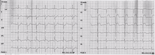 P163 Q58