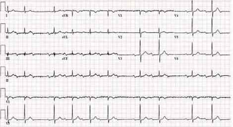 C-2Diagnosis