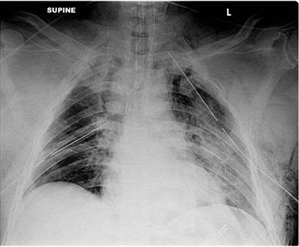 USMLE Surgery