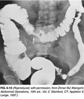 USMLE Surgery