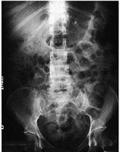 USMLE Surgery