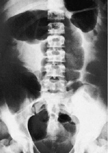 USMLE Surgery