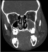 USMLE Pediatry 988 qcm