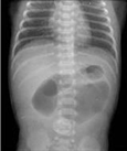 USMLE Pediatry 988 qcm