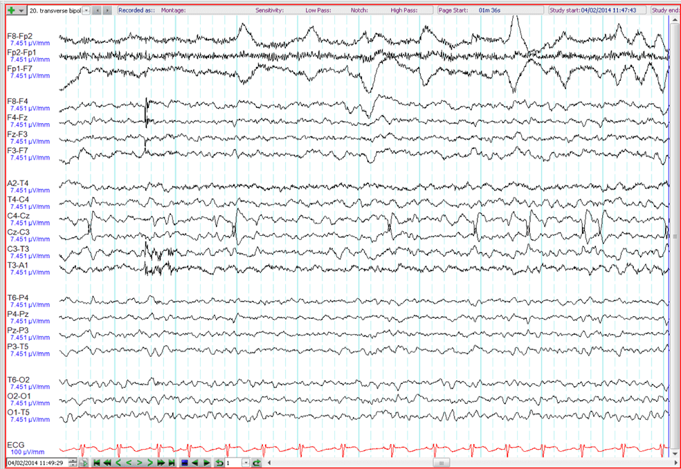 ANZAN EEG Course Quiz 2019 GOOD Take the Quiz QuizMaker