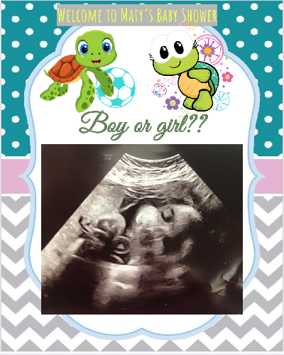 Maty's sonogram